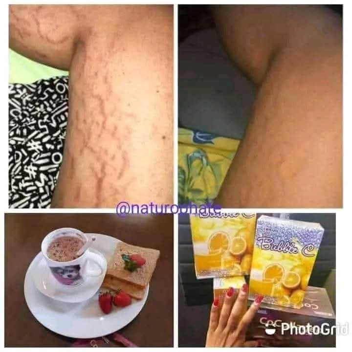 Shake off, Cocollagen, Bubble c de edmark